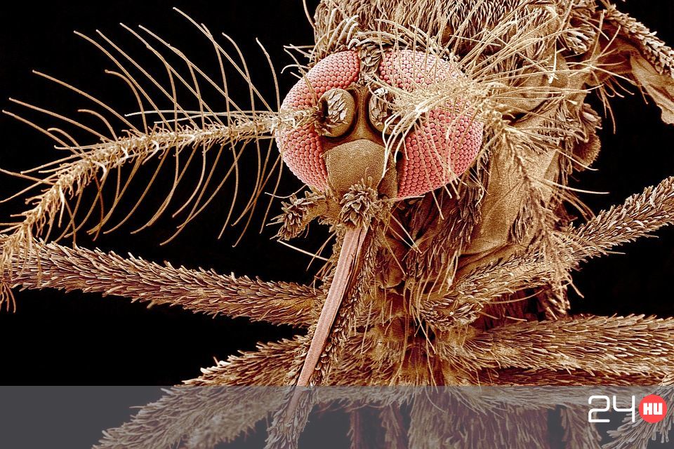 milyen paraziták élhetnek a testben a végbélben viszketés parazitákkal