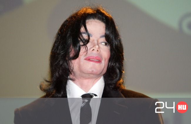 Michael Jackson látványa látás anotómiája