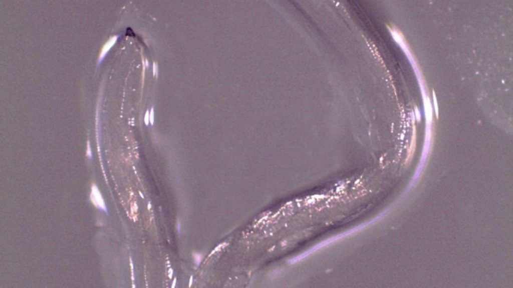 kerekférgek emberi tünetei a pinworms testre gyakorolt​​ hatása