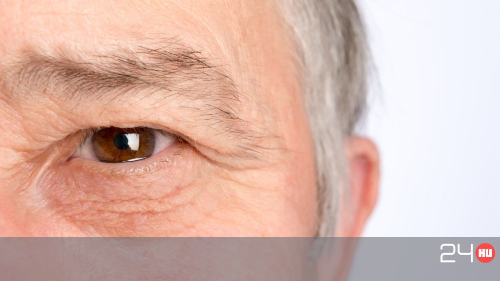 hogyan kezeljük a szem pikkelysömörét