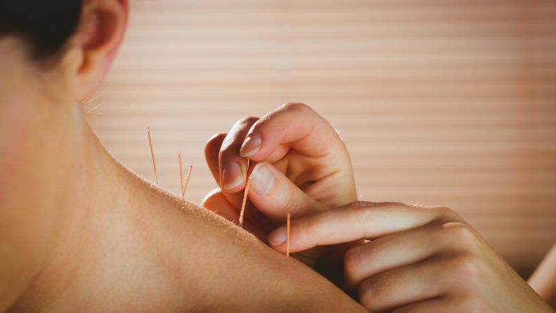 pikkelysömör akupunktúrás kezelés