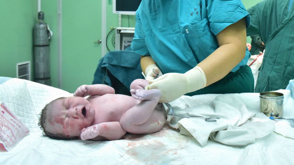 Pénisz nélkül született egy kisfiú Törökországban | nlc