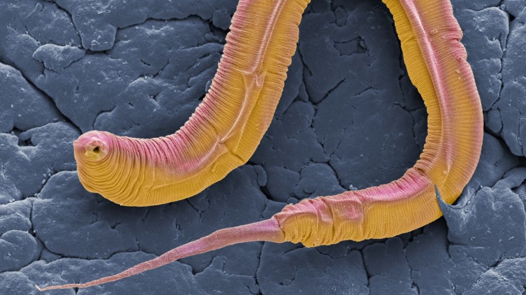 nagy kerekes féreg galandféreg a fertőzés okai